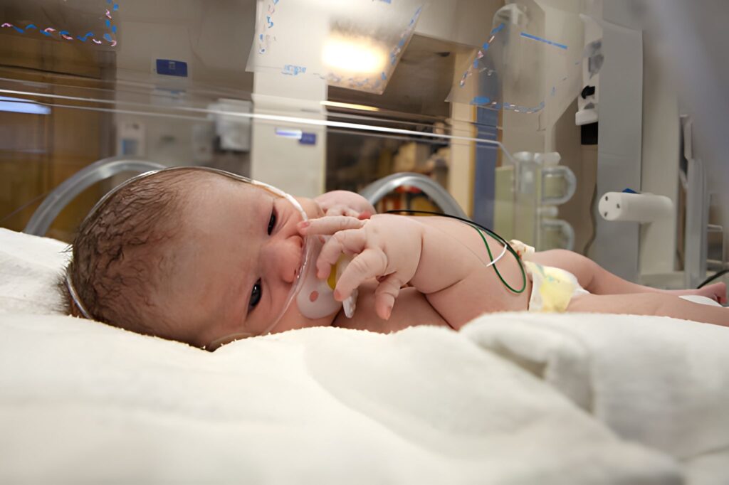10-Day-Old Mechanically Ventilated Newborn