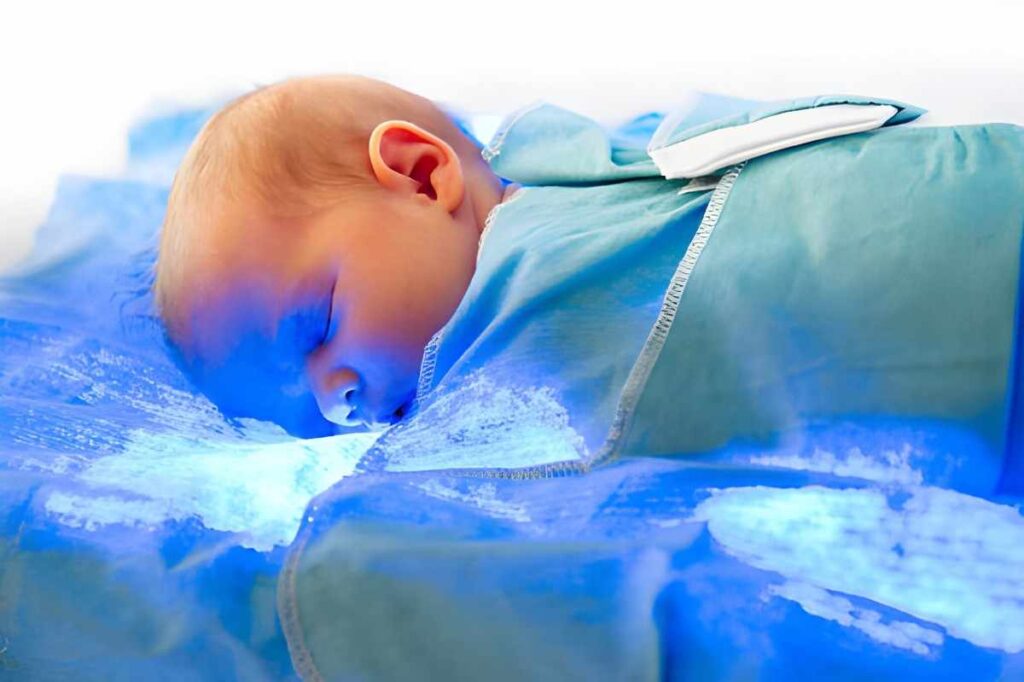 27-Week Preterm Newborn Receiving Phototherapy