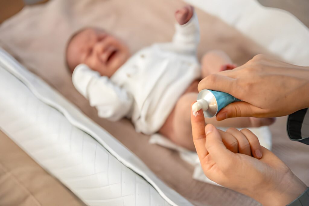 A&D Ointment Use in Newborns