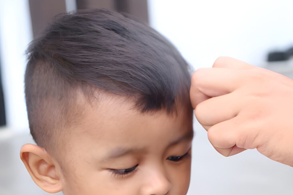 Abnormal Hair Growth in Children