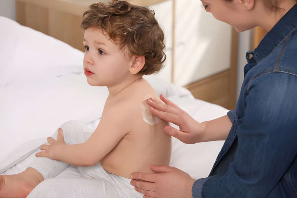 Hydrocortisone Cream for Toddlers