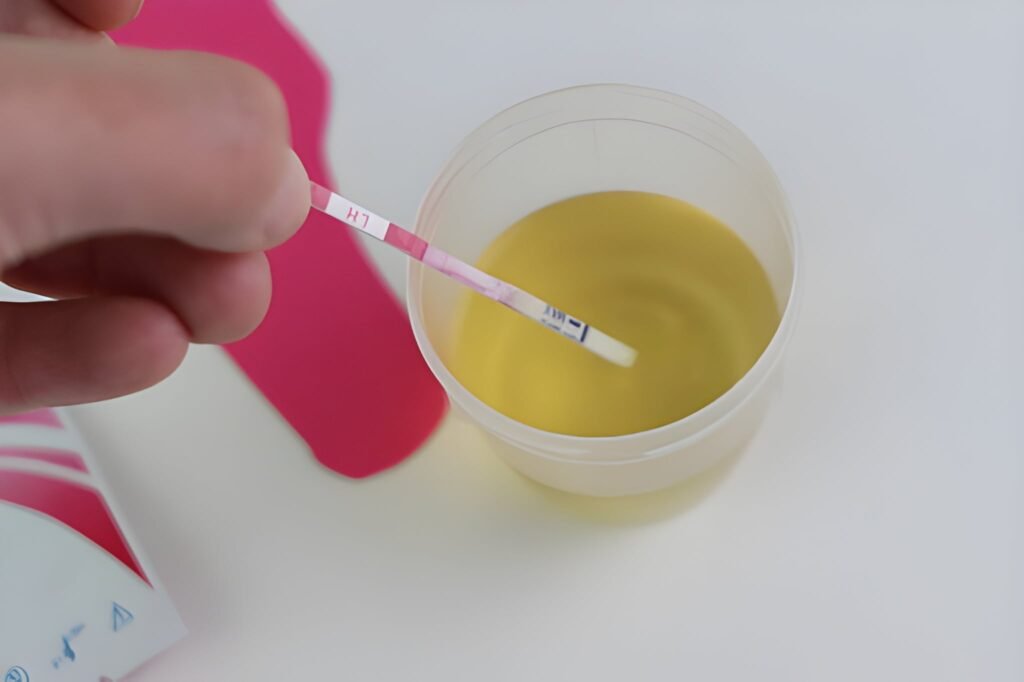 24-Hour Urine Protein Test in Pregnancy