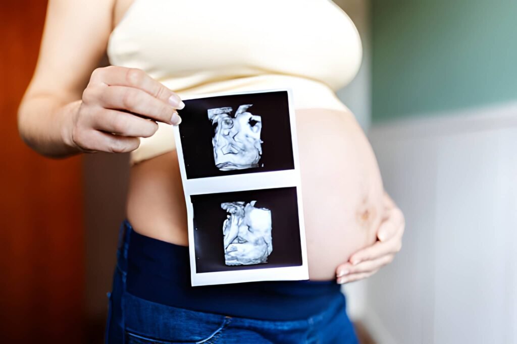 33 Weeks Twin Pregnancy The Final Sprint—Monitoring, Discomfort, and Delivery Preparation