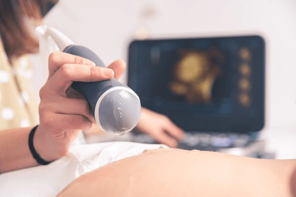 4D Ultrasound in Pregnancy Technology, Timing, and the Bonding Experience