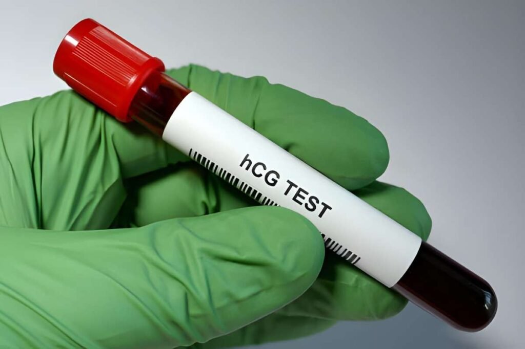 4th Week Pregnancy hCG Levels Understanding Your Confirmed Result and Ranges