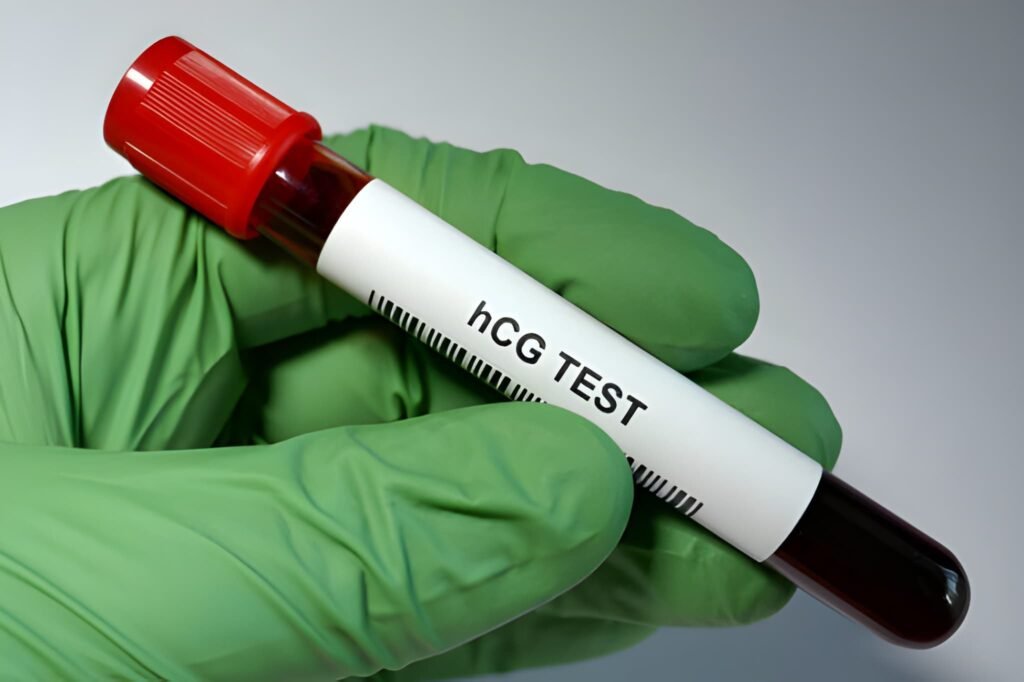 6 Days Post 5-Day Transfer (6dp5dt) Positive HCG Science, Trigger Shot Risk, and Confirmation Protocol