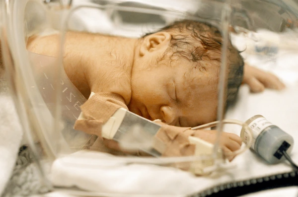 Beyond the Incubator Testing the Impact of Kangaroo Care on Preterm Breastfeeding