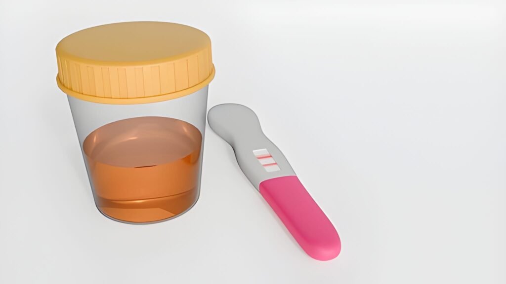 Lactobacillus at 100,000 CFUmL in Pregnancy Urine Is It an Infection