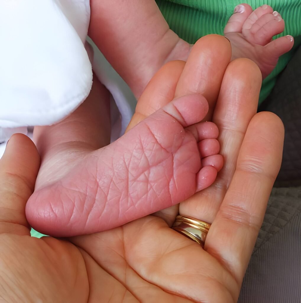 Nature's Golden Slippers The Anatomy of a Newborn Foal's Foot