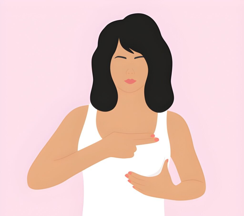 Navigating Breast Lumps During Lactation A Clinical Guide to Comfort and Care