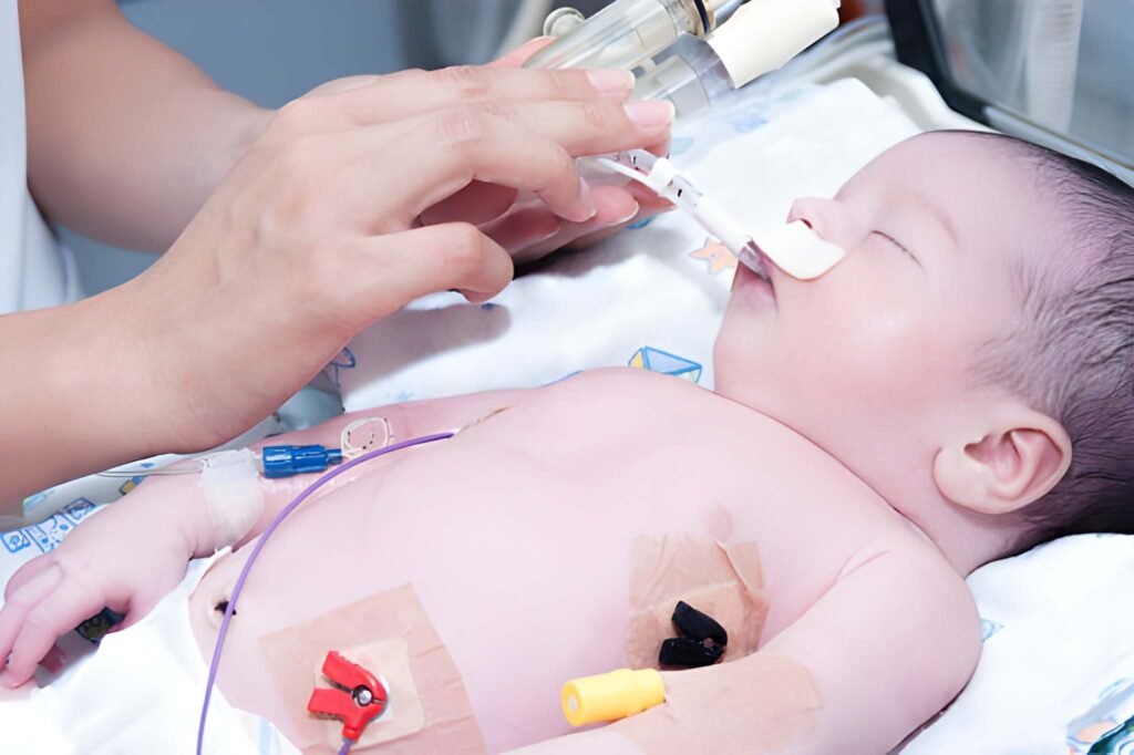 Neonatal Airway Management Navigating Respiratory Distress and Suctioning Protocols