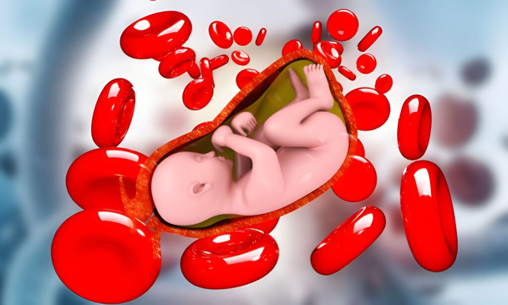 Newborn Hemoglobin and Hematocrit