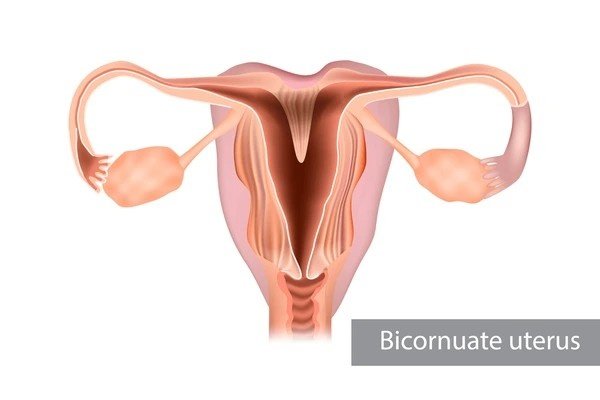 Pregnancy with Uterus Didelphys Clinical Management of a Double Uterus