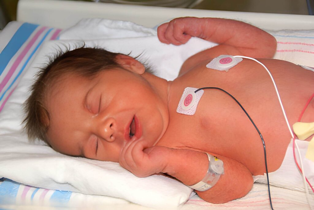 Rhythms of Life A Guide to Normal Newborn Heart Rates
