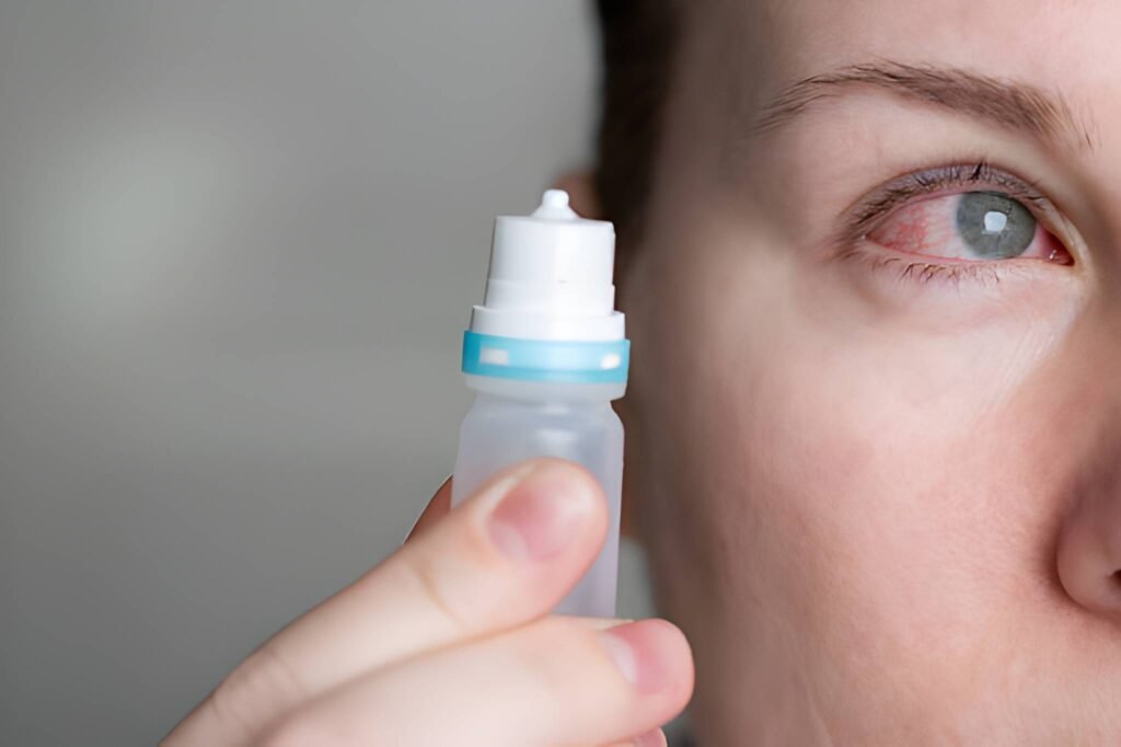 Steroid Eye Drops and Breastfeeding A Clinical Perspective on Ocular Safety