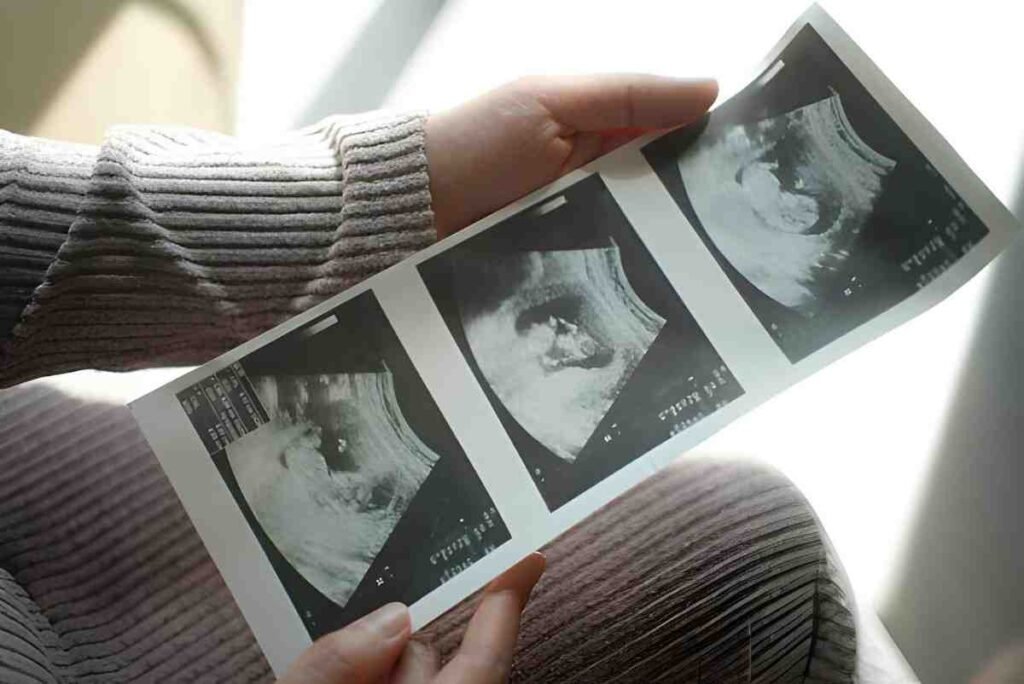 The 16-Week Pregnancy Scan Understanding Growth, Milestones, and Early Anatomy