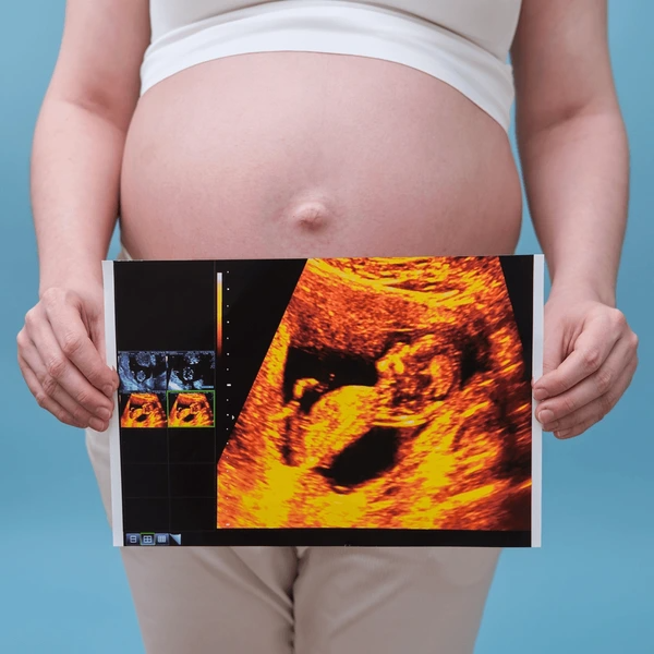 The Third Ultrasound Fetal Growth and Wellbeing Scan (Third Trimester)