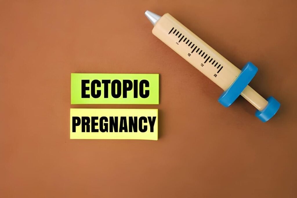 Two Doses of Methotrexate for Ectopic Pregnancy Protocol and Efficacy
